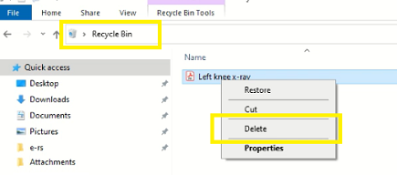 Image of the recycle bin window and the delete option