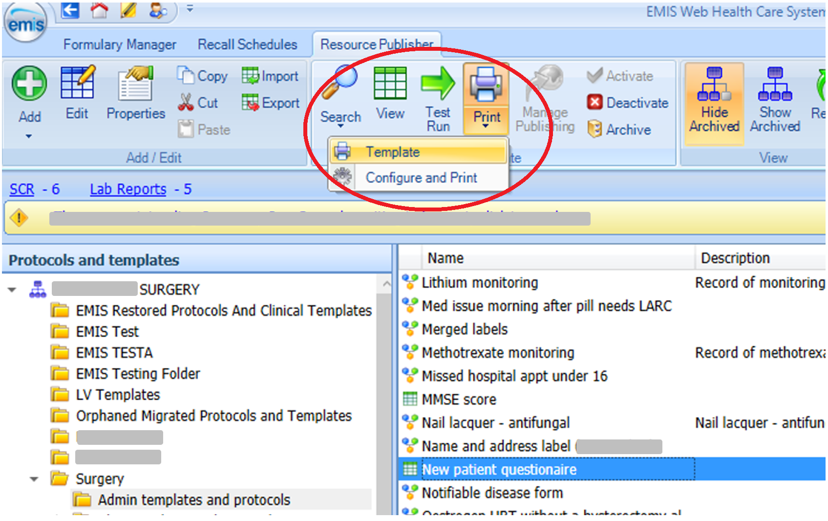 screenshot showing Template selected