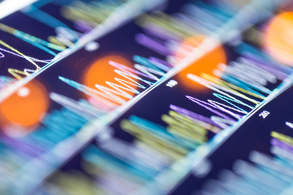 An abstract image to represent medical data digitally