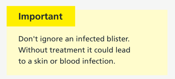 Example of warning callout with the heading of important